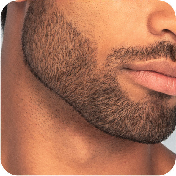Remington MB7050  T-Series Hair & Beard Kit